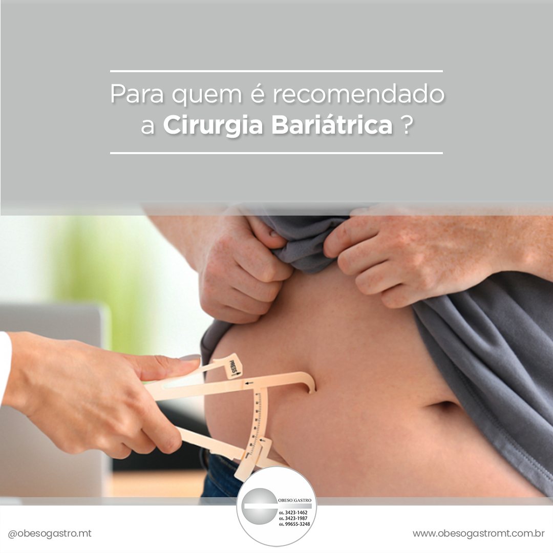 Para quem é indicado a Cirurgia Bariátrica? – Obeso Gastro MT – Clinica